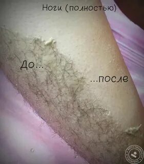 Схема бикини воском