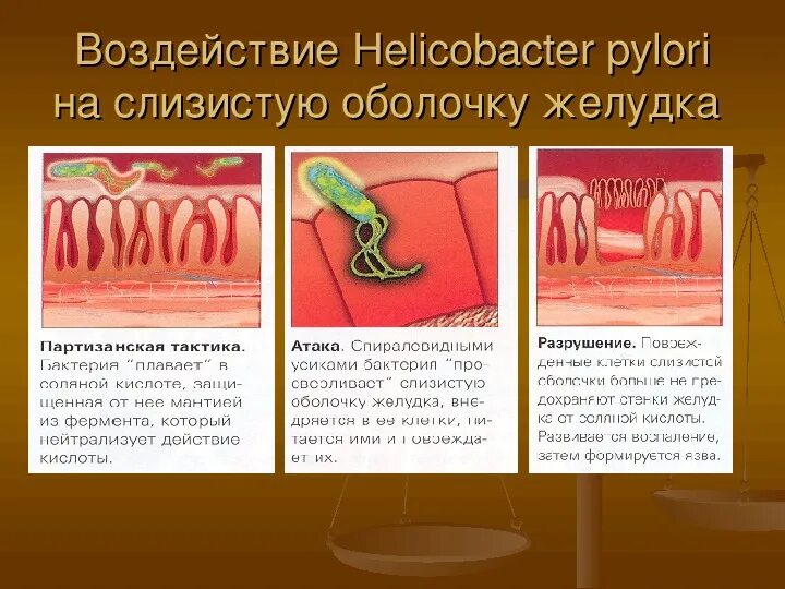 Бактерии хеликобактер причины. Хеликобактер пилори язвенная болезнь. Язвенная болезнь желудка хеликобактер. Язва желудка хеликобактер. Влияние хеликобактер пилори на желудок.