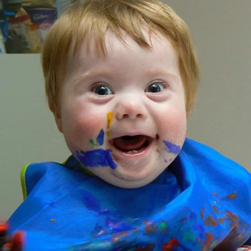 Солнечные дети с синдромом дауна. Красивые дети с синдромом дауна. Синдром дауна. Солнечные дети. Синдром дауна.