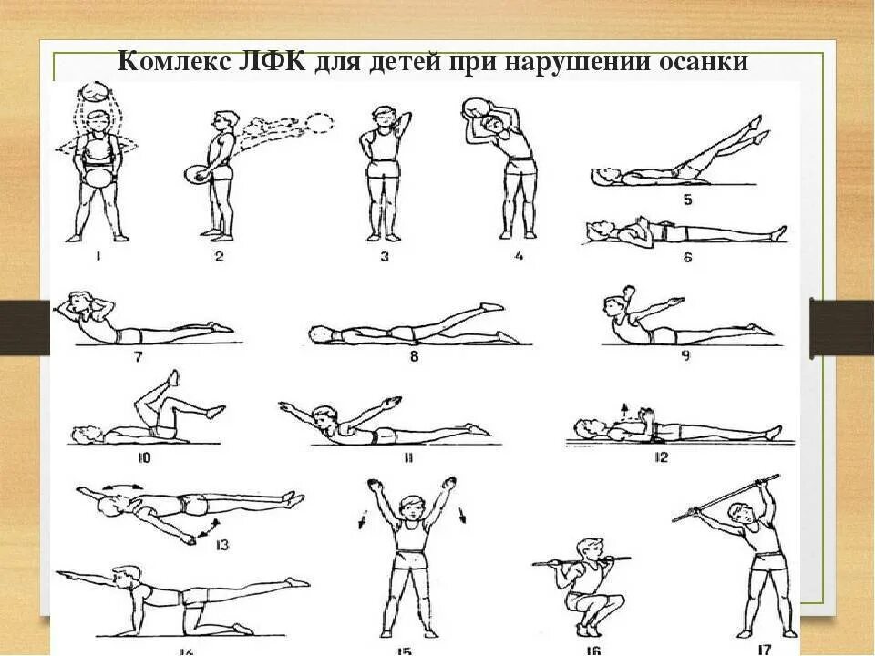 ЛФК кифоз грудного отдела. Грудной кифоз ЛФК упражнения. Упражнения при сколиозе позвоночника у детей 1 степени. ЛФК при кифозе грудного отдела. Гимнастика спины ребенку