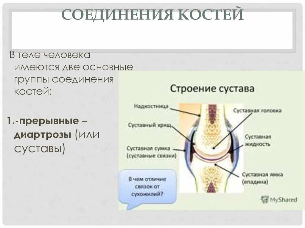 Прерывное соединение кости. Прерывные соединения суставы. Прерывные соединения костей. Диартроз соединение костей. Прерывные соединения костей диартрозы.