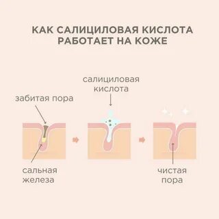 Салициловая кислота от закрытых комедонов