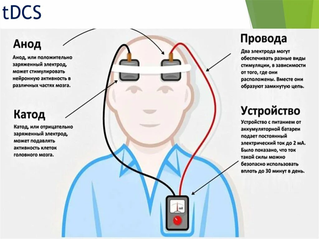 Как работает стимуляция. Tdcs транскраниальная. транскраниальная электроанальгезия методика. транскраниальная электростимуляция методика. аппарат транскраниальной электростимуляции головного мозга.