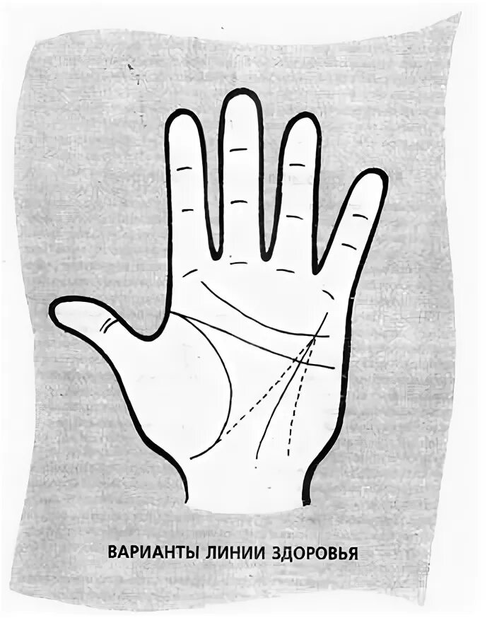 Линия здоровья пересекает линию. Расшифровка линии здоровья. Расшифровка линии здоровья. Хиромантия линии на руке. Хиромантия линия здоровья.