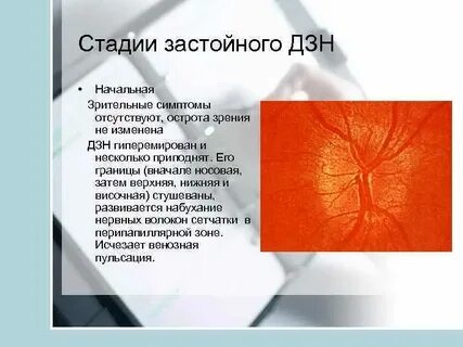 Застойный диск зрительного нерва