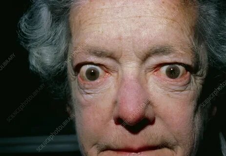 Both eyes