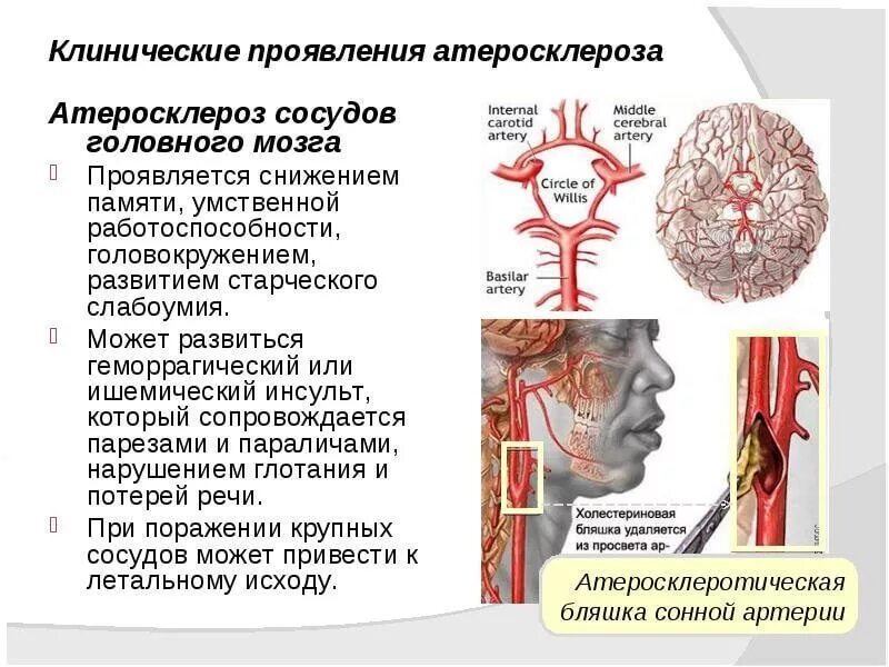 Поражение мозга лечение. Клинические проявления атеросклероза сосудов головного мозга. Клинические проявления атеросклероза мозговых артерий. Атеросклеротическое поражение магистральных артерий головы. Атеросклероз магистральных артерий головы симптомы.