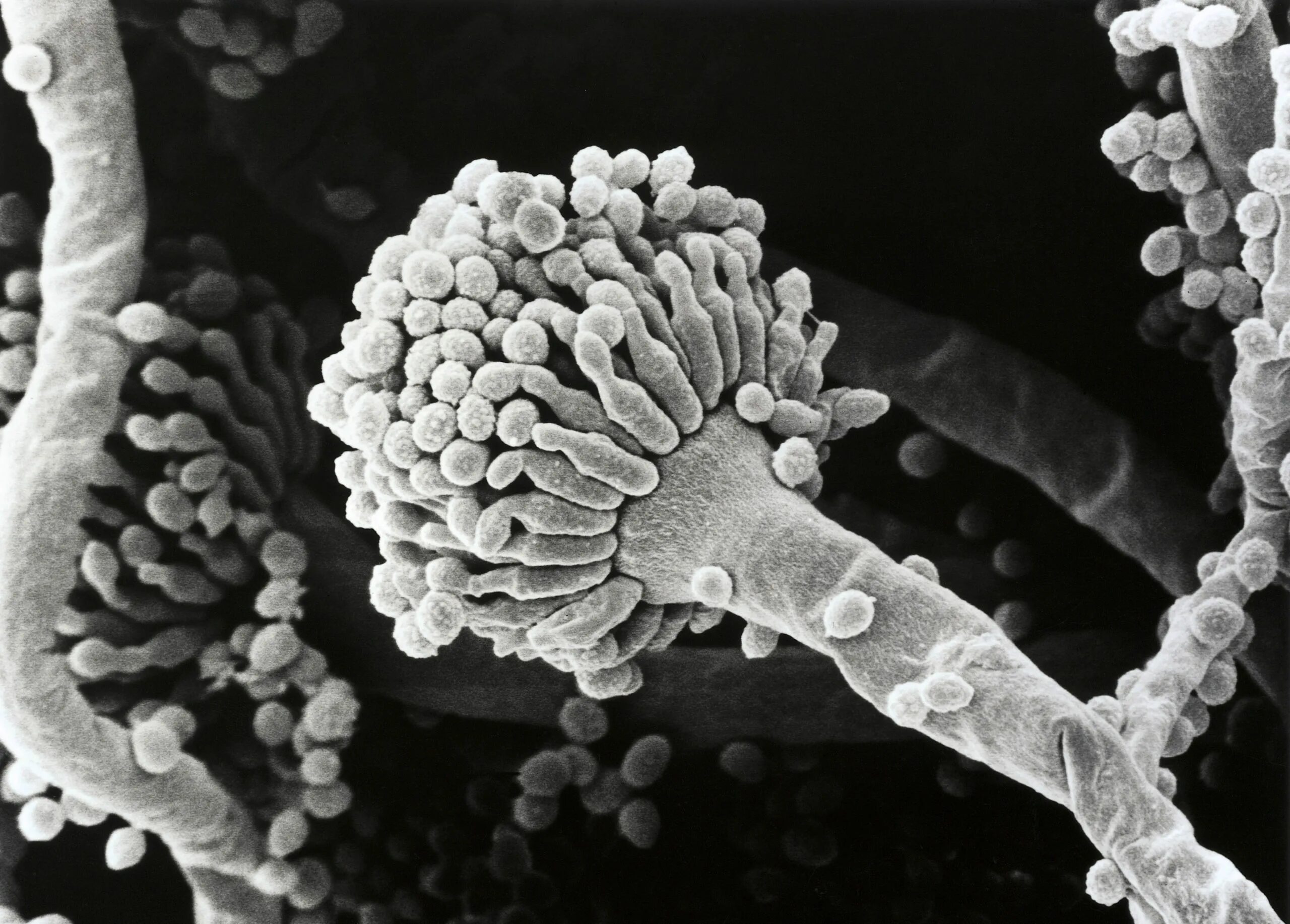 Патогенные грибы споры. Aspergillus fumigatus - гриб. Грибы рода Aspergillus. Грибок Aspergillus flavus.. Плесневые грибы аспергилл.