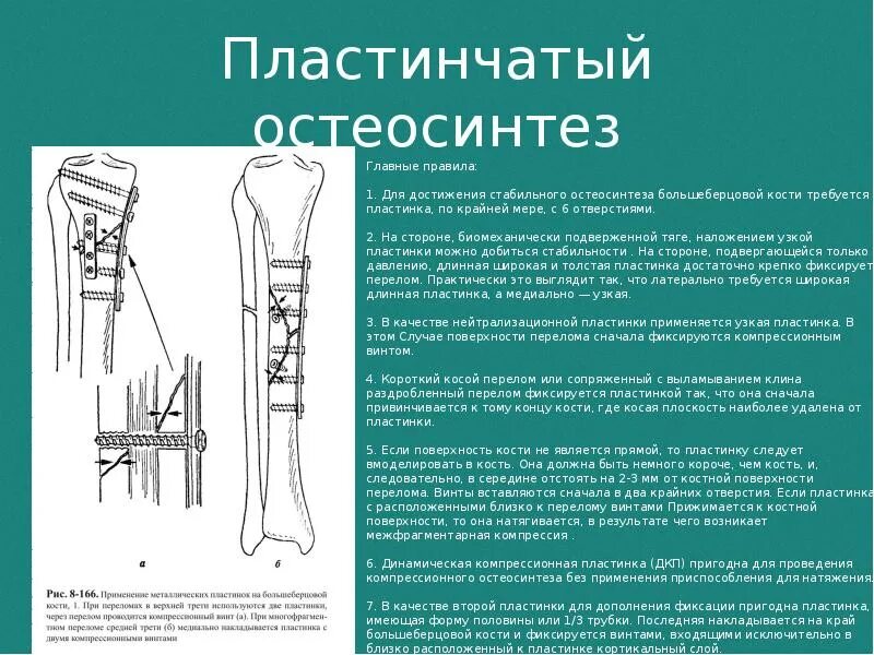 После операции на берцовой кости. Остеосинтез перелома берцовой кости. Остеосинтез при переломах костей. Перелом большеберцовой кости остеосинтез. Остеосинтез диафиза большеберцовой кости.