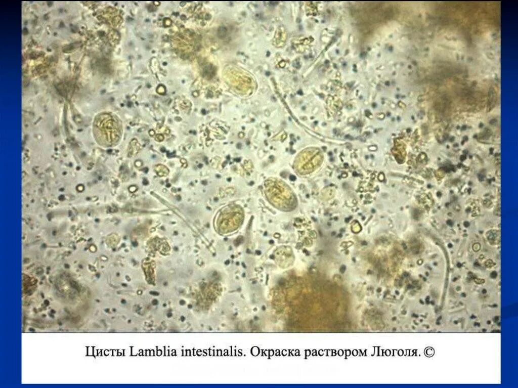 Цисты лямблий микроскопия кала. Лямблии микроскопия кала. Ооцисты лямблий микроскопия. Простейшие в кале лечение