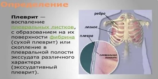 Боли в спине и ребрах причины. Под ребрами на спине.