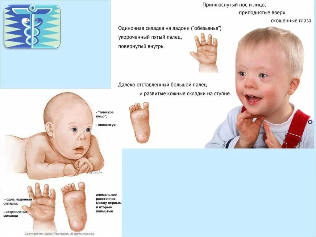 Болезни которые передаются по наследству