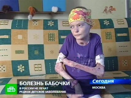 Человек бабочка