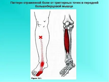 Болят передние мышцы голени