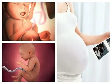 33 недели заболела