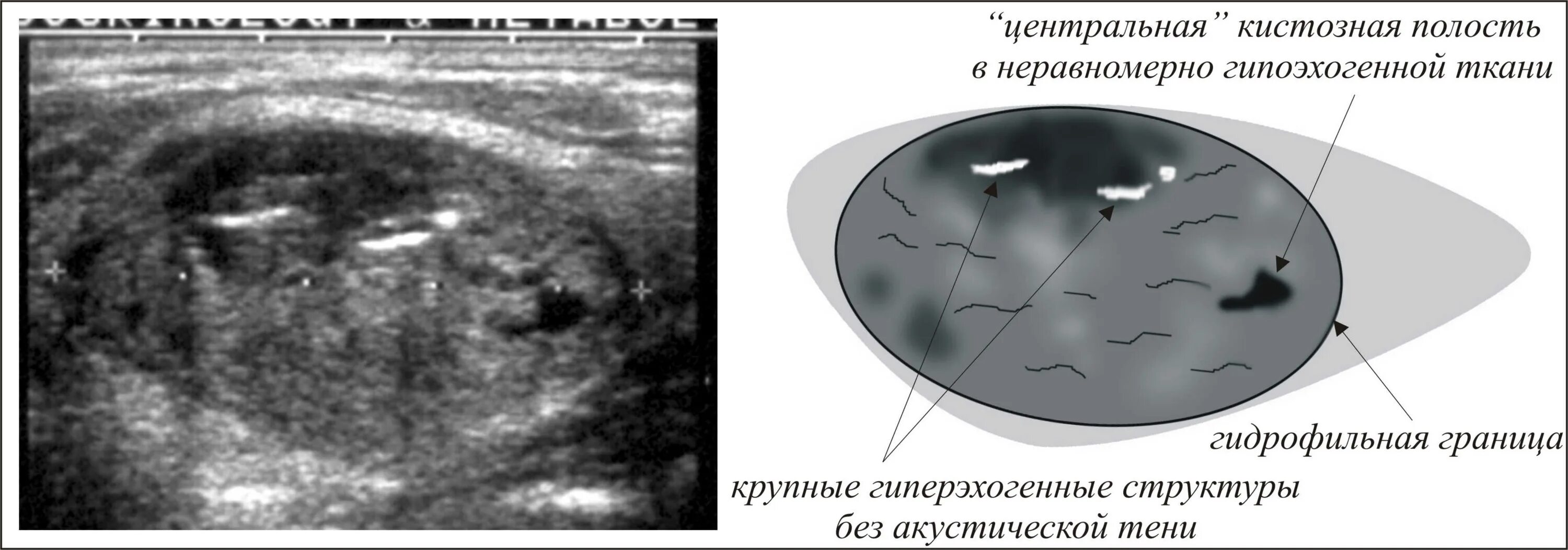 Неоднородное округлое образование