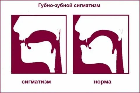 Зубной звук