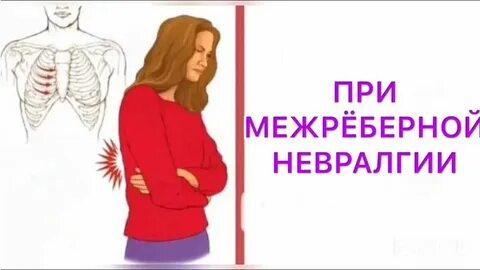 Невралгия сердца симптомы у мужчин