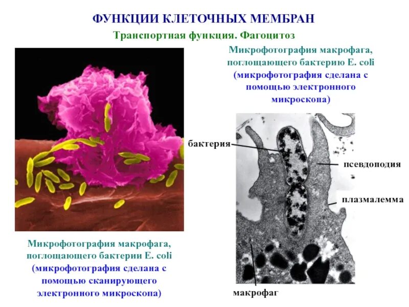 Фагоцит микрофотография. Макрофаги электронная микроскопия. Макрофаг фагоцитоз бактерию. Макрофаги это клетки. Макрофаги фагоцитоз