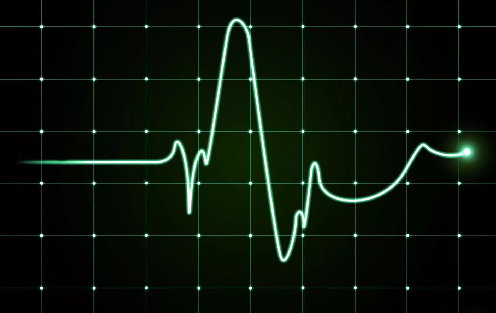 Линия биения сердца. Линия пульса. Пульс графикой. Кардиограмма. Ритм биения сердца.