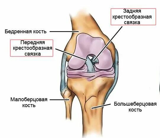 ПКС (передняя крестообразная связка). Пластика задней крестообразной связки. Крестообразные связки коленного сустава функции. Отрыв задней крестообразной связки. Полный разрыв передней крестообразной