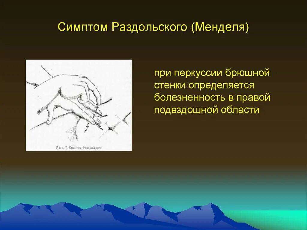 Симптом Менделя. Положительный симптом Менделя. Симптом Менделя Раздольского. Симптом Менделя и Щеткина-Блюмберга.