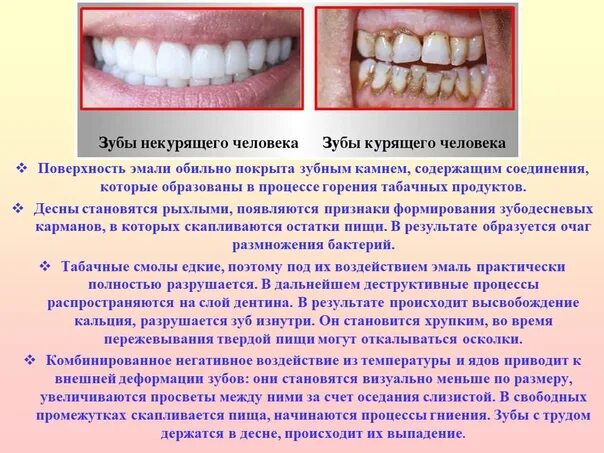 Можно курить после лечения зуба