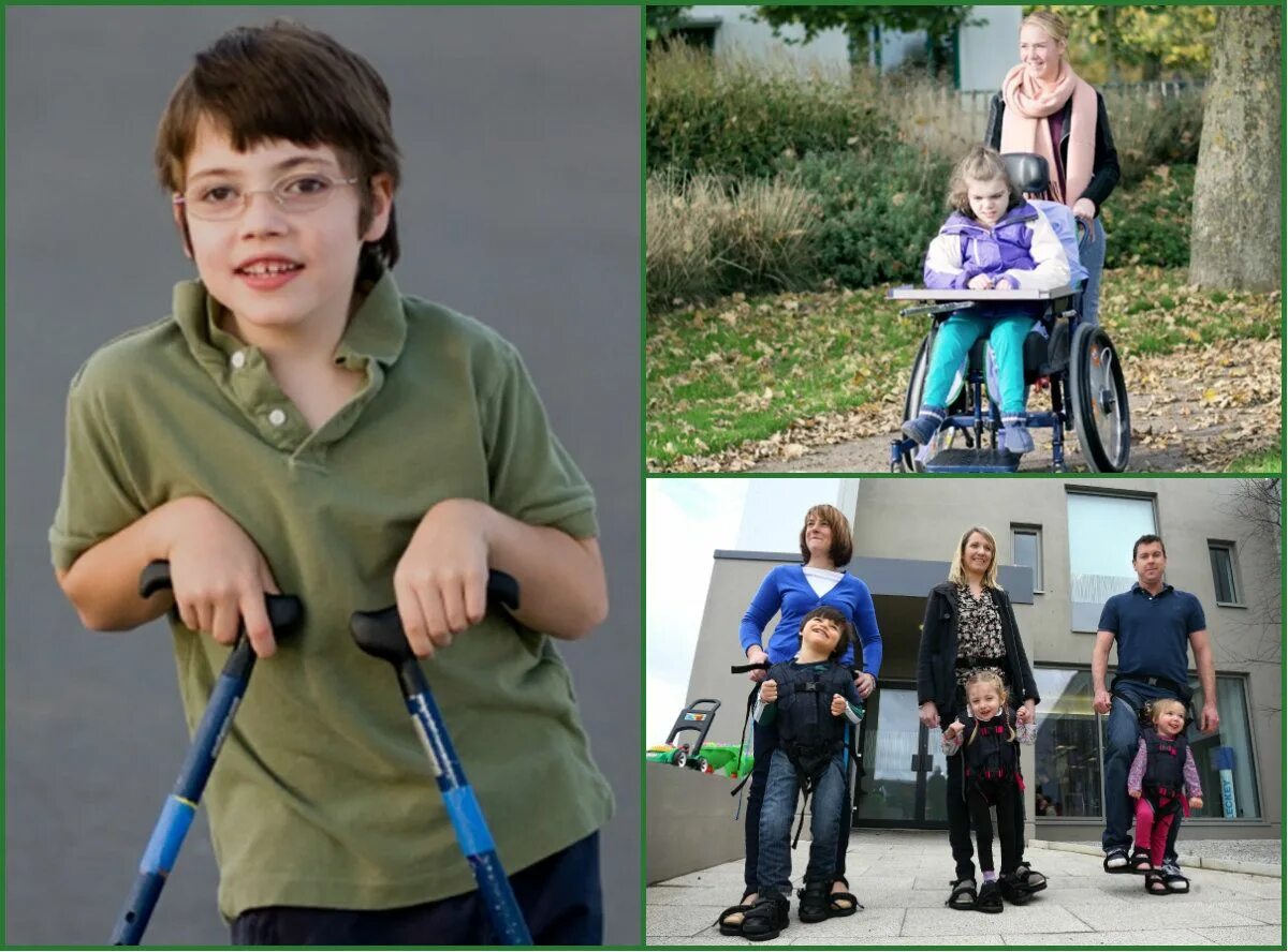 Инвалид с детства с возраста. ДЦП. Детский церебральный паралич. Детский ДЦП. ДЦП фото.