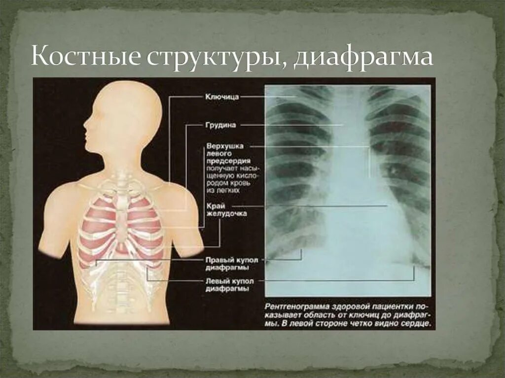 Области грудной клетки. От чего может болеть грудная клетка