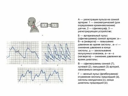 Регистрация пульса