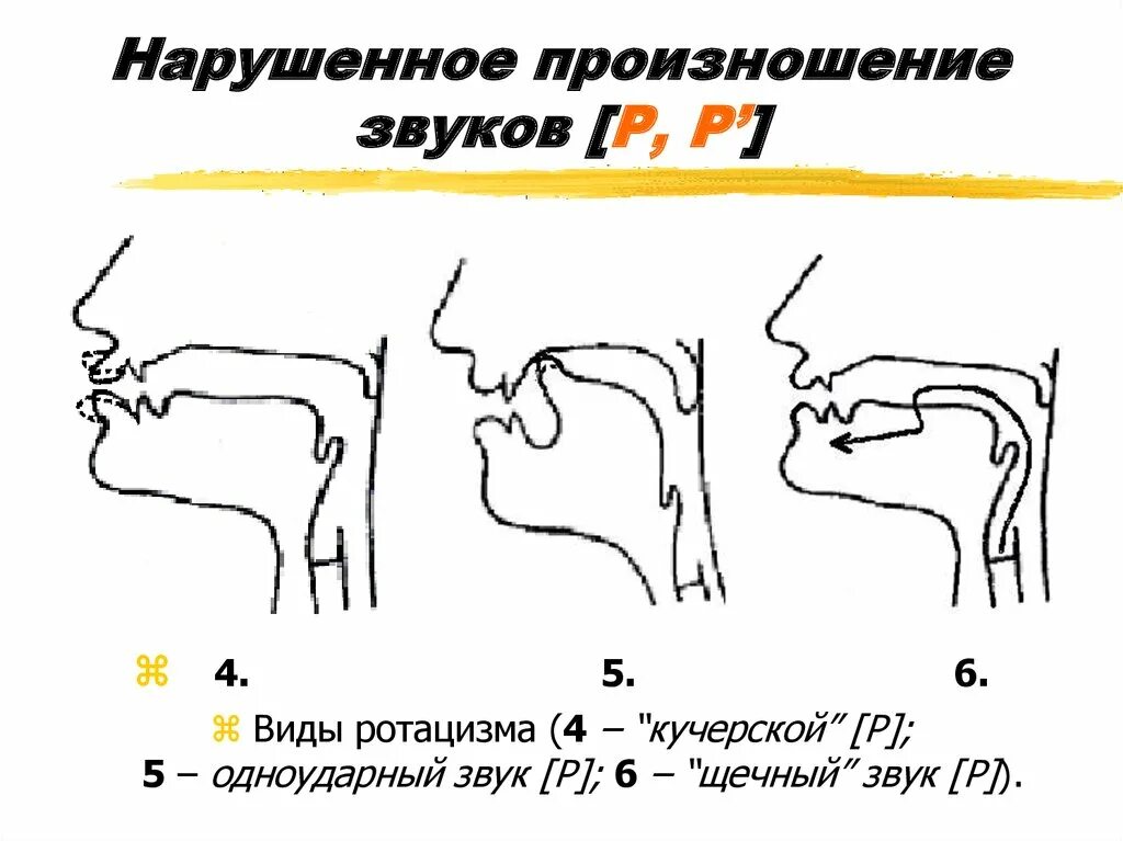 Артикуляционные профили при ротацизме. Нарушение произношения звука р. Неправильное произношение звука р. Увулярное произношение звука р. Этапы звука произношения