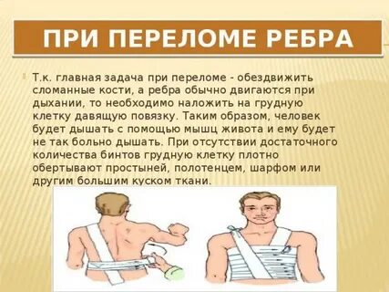 Какое обезболивающее при переломе ребра