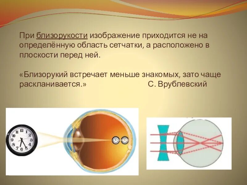 Дополните предложения изображение в близоруком глазу фокусируется