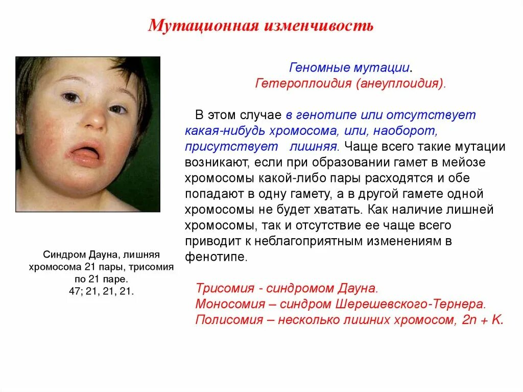 Синдром дауна генотип и фенотип. Мутационная изменчивость синдром дауна. синдром дауна это анеуплоидия. тип мутация синдром дауна гетероплоидия. мутационная изменчивость примеры.