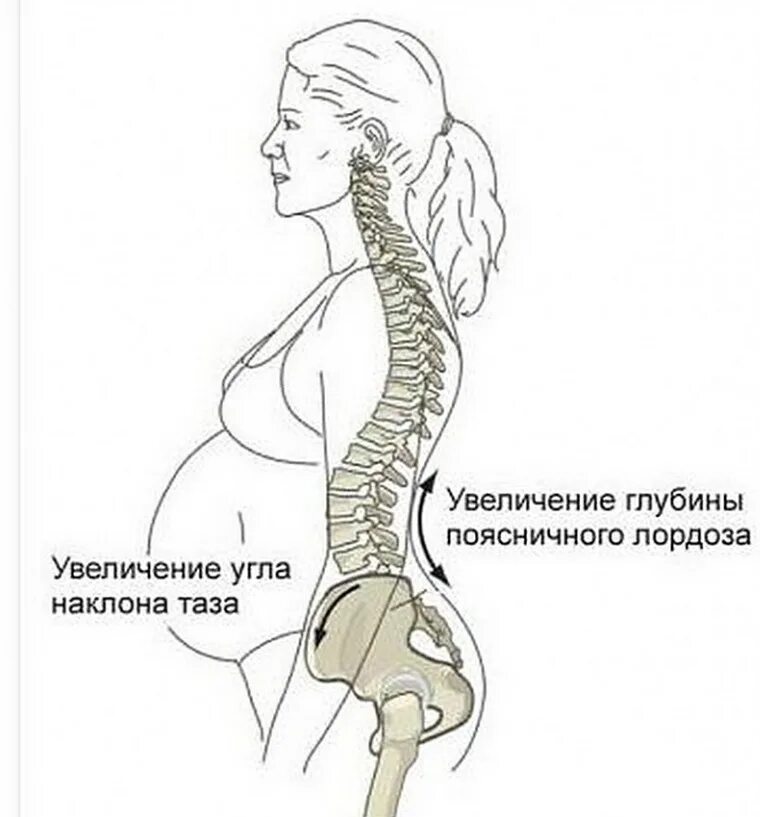 Беременность и позвоночник. Позвоночник у беременных.