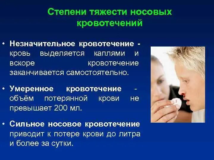 Носовое кровотечение из носа. Степени носового кровотечения. Степени тяжести носового кровотечения. Степени тяжести при носовом кровотечении. Кровотечение степени кровотечения.