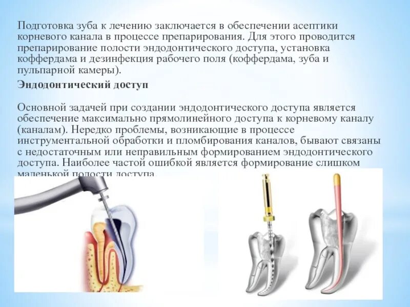 Шаги механической обработки корневых каналов. Этапы вскрытия полости зуба эндодонтия. Препарирование корневого канала