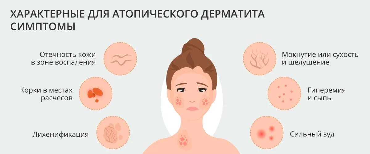 Высыпания на коже температура головная боль