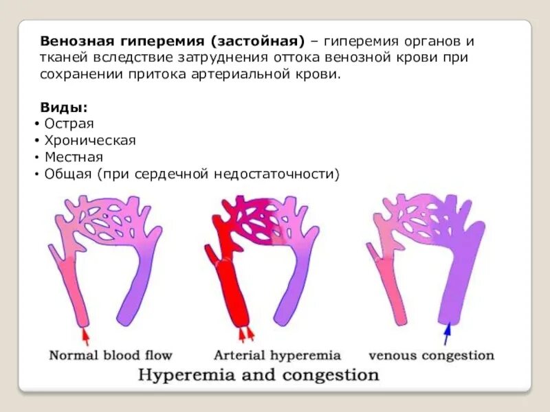 Типы гиперемии