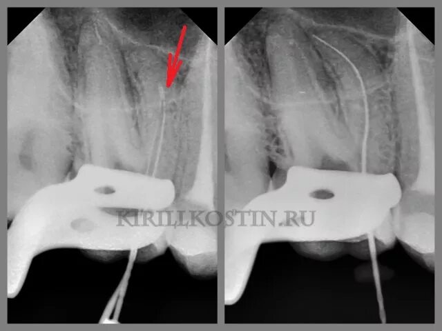 акт восприятия начинается с.