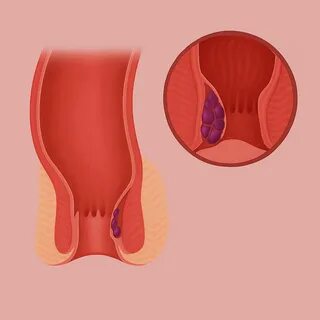 Химера арқылы секс