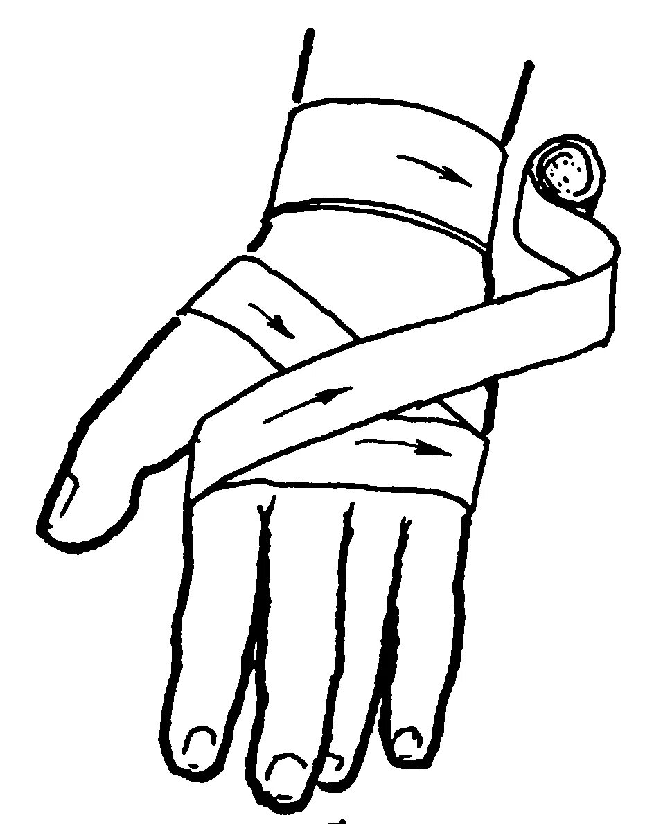 Повязка на руку схема. Крестообразная (восьмиобразная) повязка на кисть. Перевязка кисти бинтом. Бинтовая повязка на руку. Циркулярная повязка на кисть.