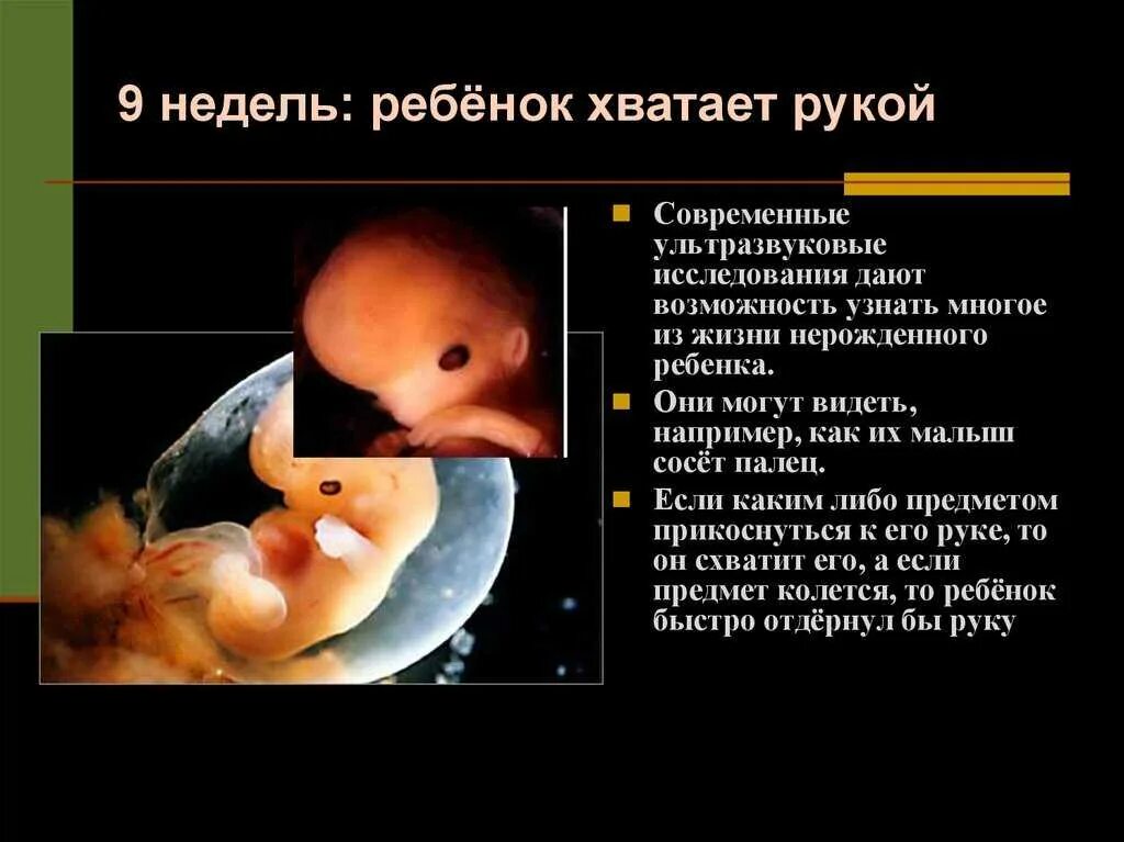 Как выглядит эмбрион 9 недель фото Беременность по неделям фото плода и описание