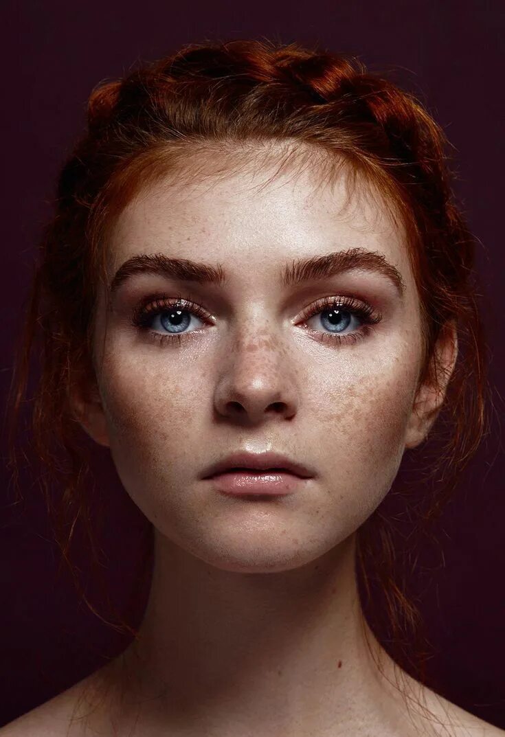 Freckles girl