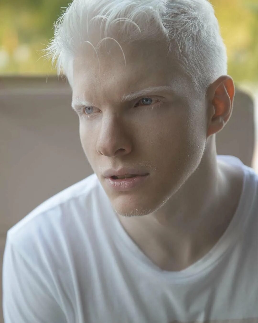 Человек с самой светлой. Шимон альбинос. Глазно-кожный альбинизм.