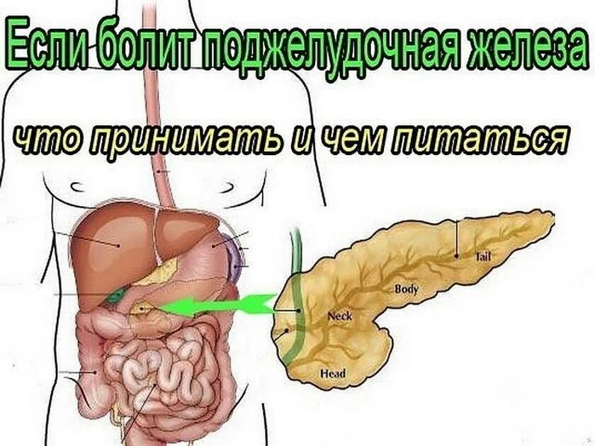 От чего может болеть поджелудочная. Поджелудлчнаяжелеза болит. Если болит поджелудочная железа.