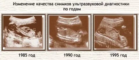 Узи старые