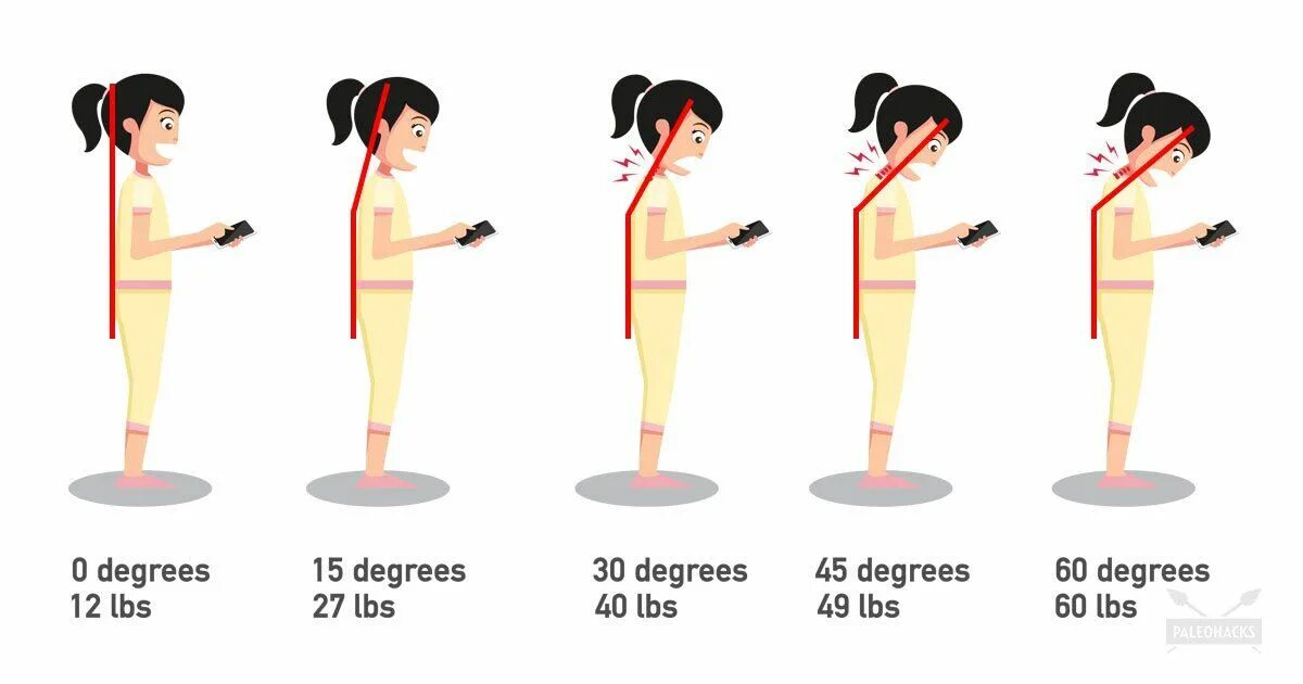 Как правильно держать голову. Осанка и смартфон. Осанка человека с телефоном. Влияние смартфона на осанку. Нагрузка при наклоне головы.