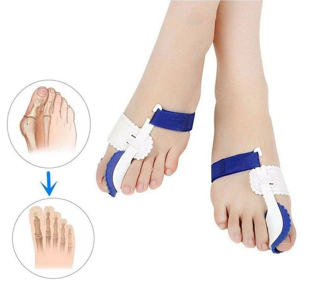 Hallux valgus корректор. Фиксатор хальгус вальгус. Ortex 024 корректор большого пальца ноги отводящая шина. Фиксатор для косточки на ноге. Вальгусная шина для большого пальца ноги.