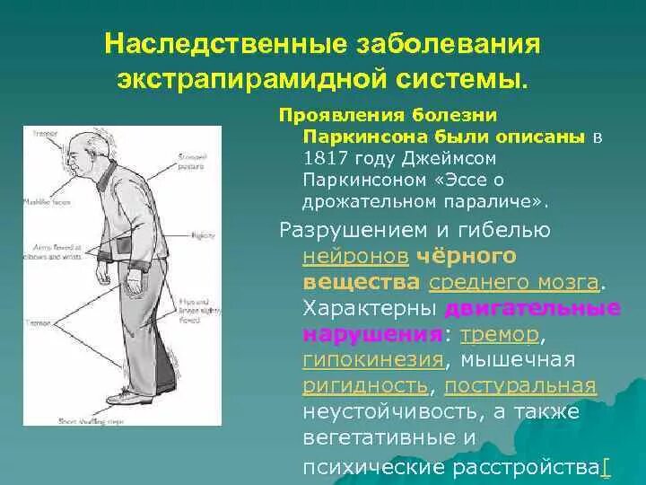 Двигательные симптомы поражения. Болезни с поражением экстрапирамидной системы. Экстрапирамидные расстройства паркинсонизм. Наследственные поражения экстрапирамидной нервной системы.. Наследственные заболевания с поражением экстрапирамидной системы.